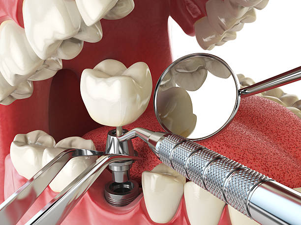 Fast & Reliable Emergency Dental Services in AL